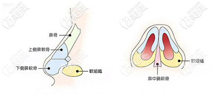 深圳美颜整形医院林仕锦隆鼻优势 深圳美颜整形医院林仕锦隆鼻优势