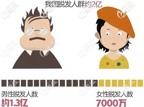 国内男女士脱发比例