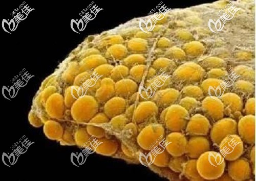 包裹脂肪细胞的纤维组织