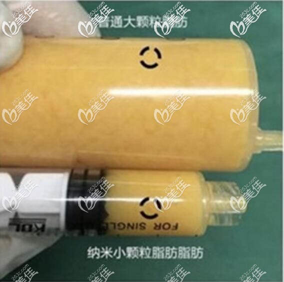 普通脂肪和脂肪胶的区别 普通脂肪和脂肪胶的区别