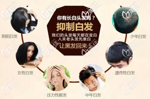 德生源何首乌洗发水治白发原理