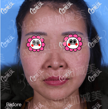 我做手术前旧照 我做手术前旧照