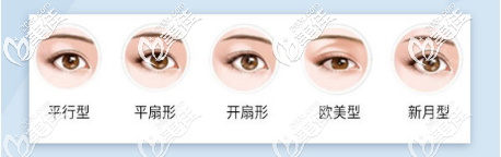 各种双眼皮类型