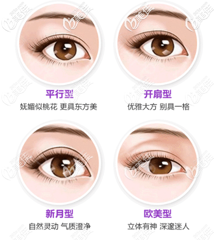 各种双眼皮类型图片 各种双眼皮类型图片