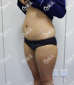 我术前的样子 我术前的样子