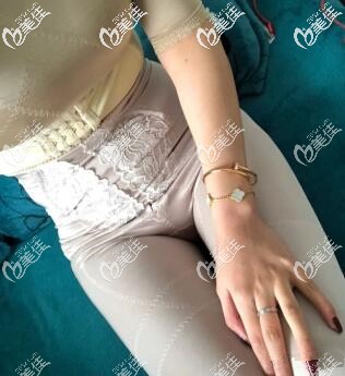 我在贵阳华美做完吸脂手术半个月了 我在贵阳华美做完吸脂手术半个月了