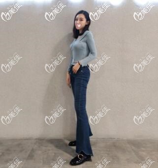 贵阳吸脂不贵还真能瘦，在贵阳华美做完腰腹+大腿抽脂3个月后我都穿xs码的裤子了