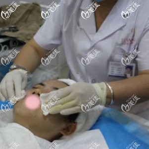 做红蓝光祛痘过程 做红蓝光祛痘过程