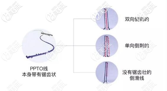 蛋白线的不同种类