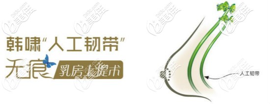 人工韧带提胸术价格揭秘 人工韧带提胸术价格揭秘