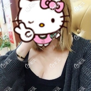 假体隆胸术后24天肿胀渐消 假体隆胸术后24天肿胀渐消