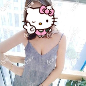 害怕隆胸后假体像球一样滑动，不如和我一样找做成脂肪+假体的复合式丰胸