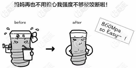 美国杰美种植牙是五级钛哦 美国杰美种植牙是五级钛哦