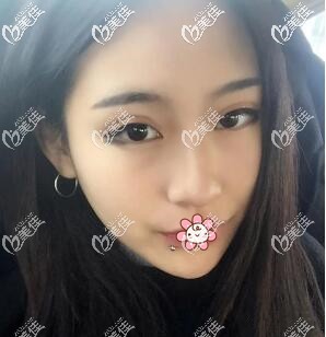 两个月以后 两个月以后