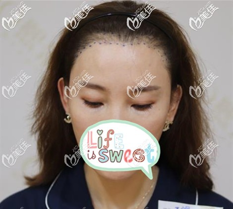 根据脸型设计的发际线 根据脸型设计的发际线