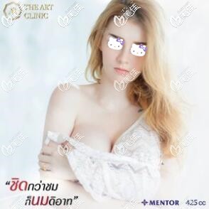 今天就把我在泰国艺术整形外科做的魔滴425cc假体隆胸真实恢复效果跟大家分享下！