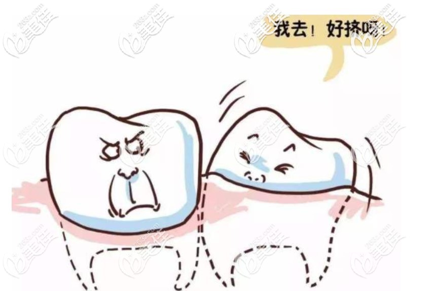 雅度口腔医生说牙齿矫正需不需要拔牙