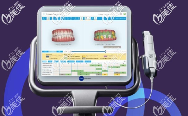牙齿矫正黑科技——Invisalign隐适美iTero扫描仪 牙齿矫正黑科技——Invisalign隐适美iTero扫描仪