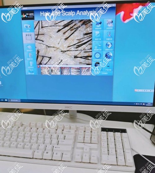 术前头皮专业毛囊检测 术前头皮专业毛囊检测