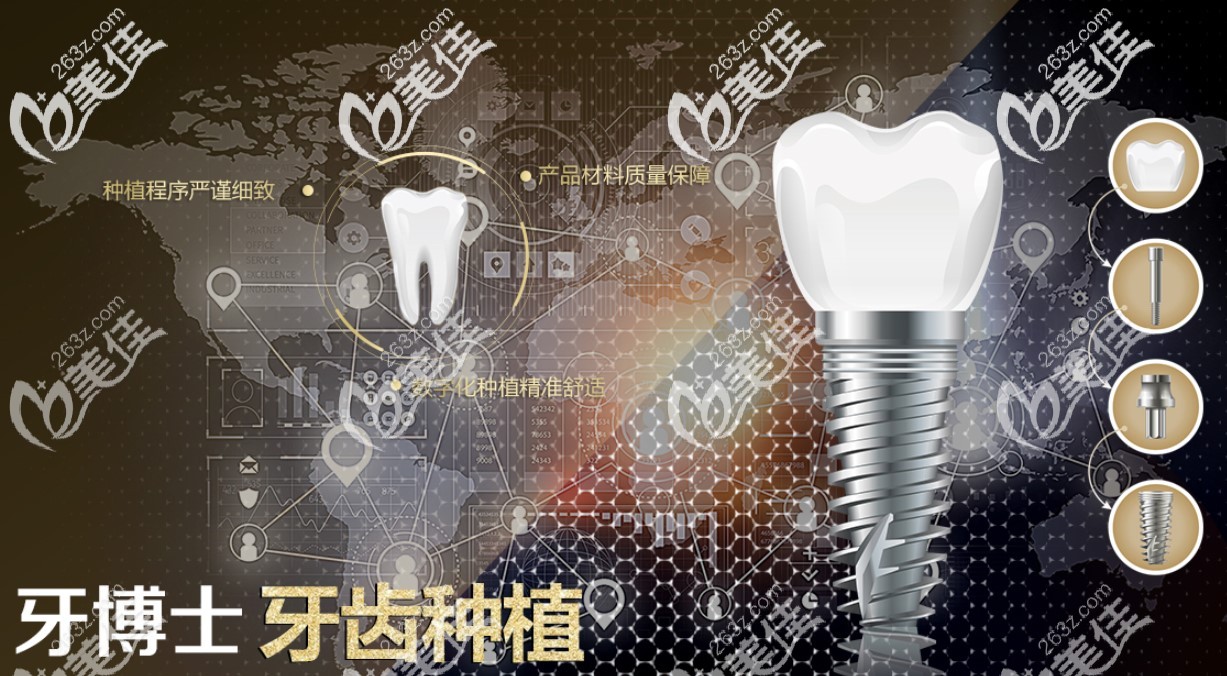 成佳牙博士口腔种植牙优势 成佳牙博士口腔种植牙优势