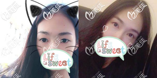 之前的眼睛虽然大,但是不够有魅力 之前的眼睛虽然大,但是不够有魅力