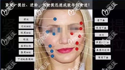 热拉提的作用效果