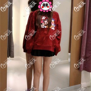 做大腿吸脂恢复20天效果怎么样? 做大腿吸脂恢复20天效果怎么样?