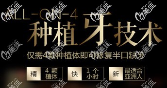 北京牙管家all-on4种植技术 北京牙管家all-on4种植技术