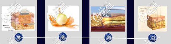 BodyTite+脂肪3D光雕科技技术原理