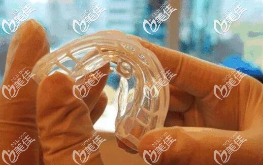 MRC儿童矫治器 MRC儿童矫治器