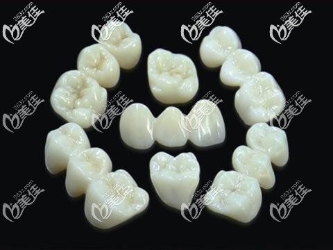 成都东篱医院爱尔创全瓷牙 成都东篱医院爱尔创全瓷牙