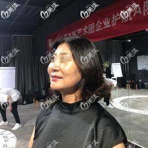 优雅斯埋线提升术后五天效果 优雅斯埋线提升术后五天效果