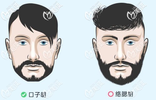 擅长口子胡种植和络腮胡种植