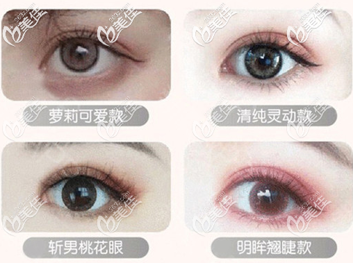 东莞天后<!--<i data=20240703-sp></i>-->双眼皮类型 东莞天后<!--<i data=20240703-sp></i>-->双眼皮类型