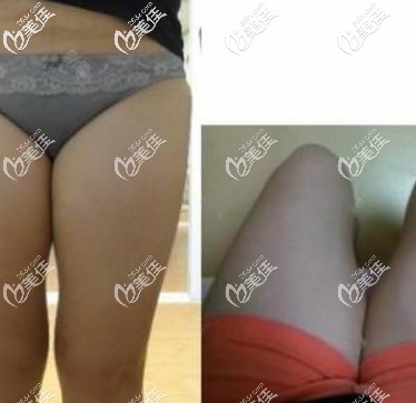 呼和浩特张高贵医疗美容门诊部张高贵术前照片1