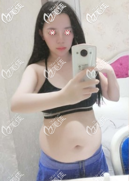 术前的我 术前的我