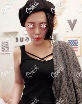 许黎腰腹吸脂术后半年 许黎腰腹吸脂术后半年