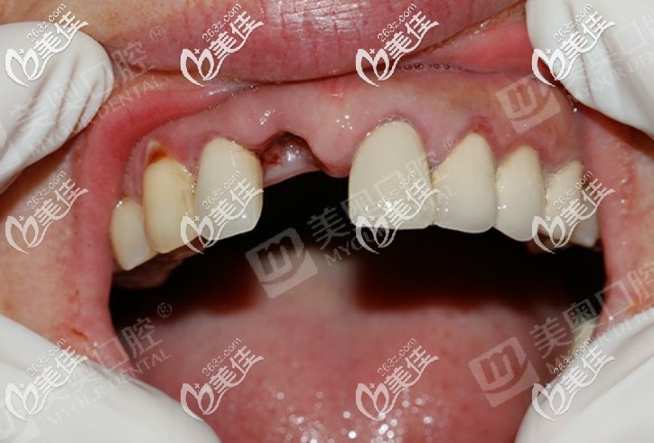 趁活动在苏州美奥<span style= 趁活动在苏州美奥<span style=