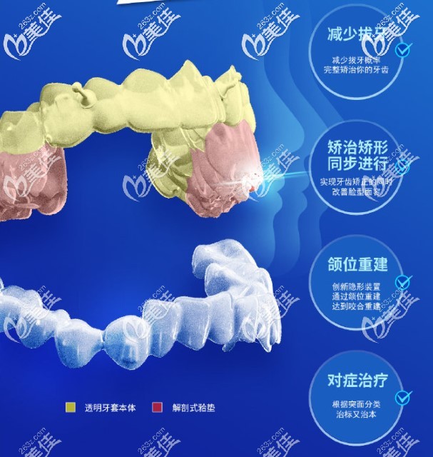 正雅隐形矫正有这些好处 正雅隐形矫正有这些好处