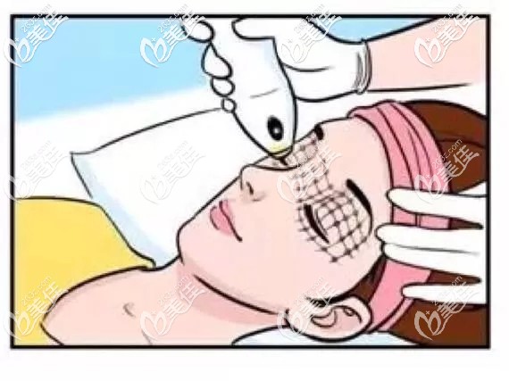 热玛吉抗衰的原理