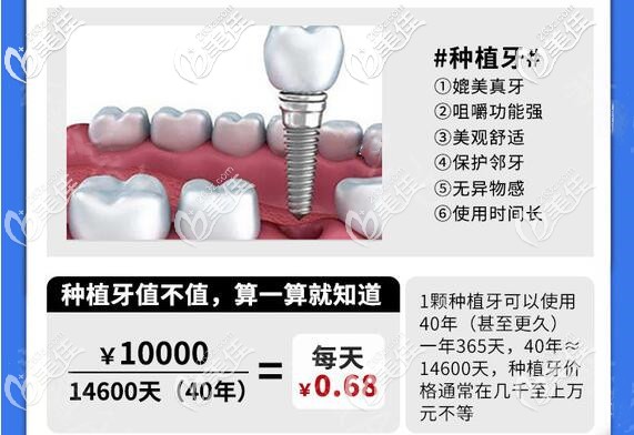 成都极光口腔种植牙收费价格贵吗 成都极光口腔种植牙收费价格贵吗