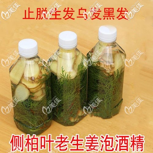 侧柏叶生姜泡酒治脱 侧柏叶生姜泡酒治脱