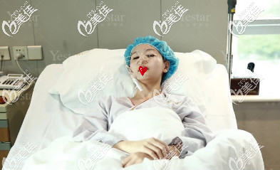 济南艺星假体隆鼻+双眼皮术后即刻照片 济南艺星假体隆鼻+双眼皮术后即刻照片