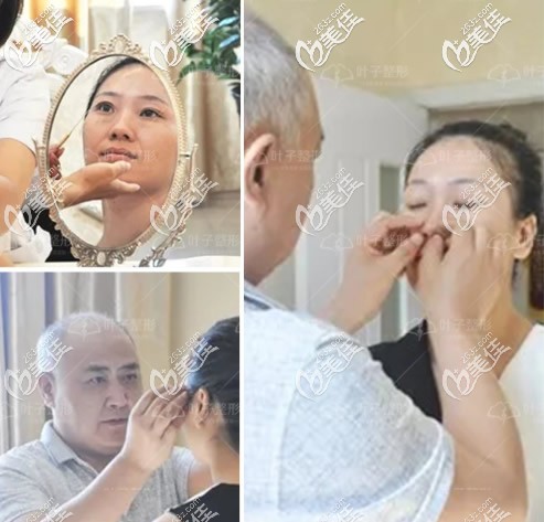 包头叶子整形医院张会堂院长隆鼻前面诊 包头叶子整形医院张会堂院长隆鼻前面诊