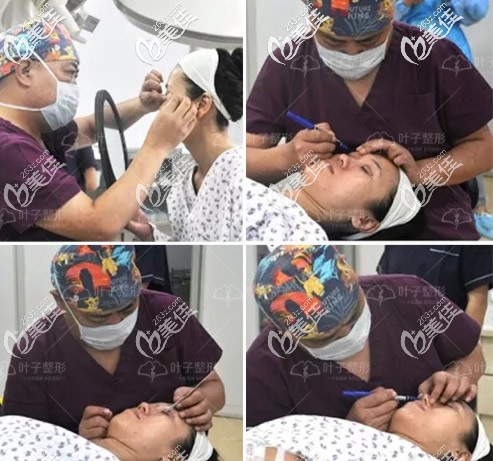 包头叶子肋软骨隆鼻前设计手术方案 包头叶子肋软骨隆鼻前设计手术方案