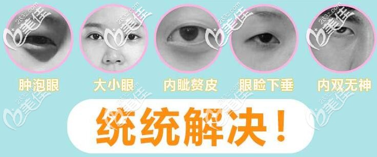 芭比眼综合可改善多种眼部问题 芭比眼综合可改善多种眼部问题