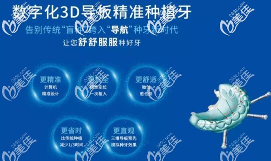3d数字化导板种植牙 3d数字化导板种植牙