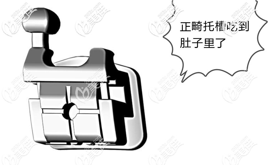 正畸托槽没粘紧吃肚子里了怎么办 正畸托槽没粘紧吃肚子里了怎么办