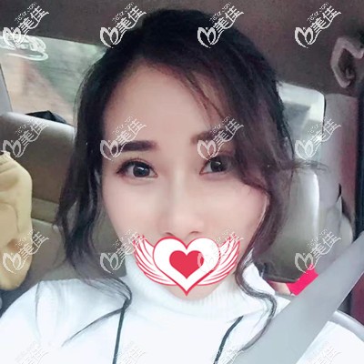 术后半个月效果