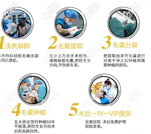 院内详细的植发流程 院内详细的植发流程
